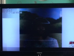 电视机竖线条纹的维修方法（教你轻松排除电视机竖线条纹问题）