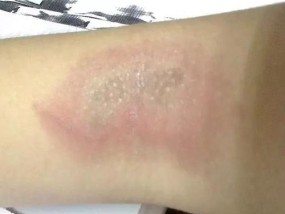 笔记本电脑进了蟑螂怎么办？如何快速清理和预防？