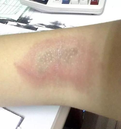 笔记本电脑进了蟑螂怎么办？如何快速清理和预防？  第1张
